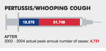 PERTUSSIS/WHOOPING COUGH. BEFORE:19,878 - WHAT IF:61,749 - AFTER:2002 - 2004 actual peak annual number of cases: 4,751